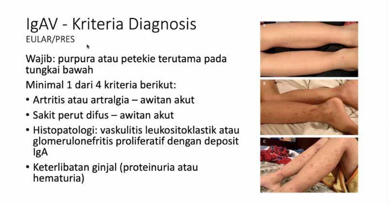 Popmama.com/Anggia Ramadhani Fitri